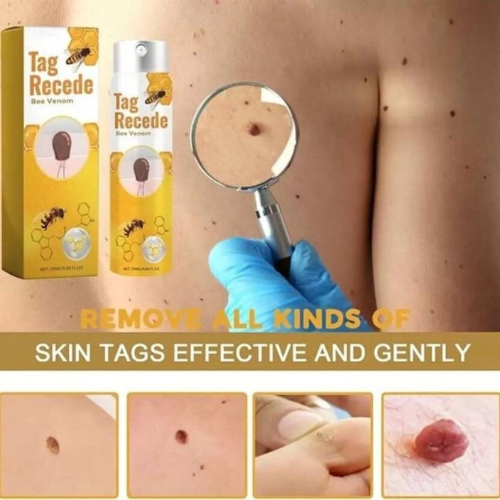 spray anti-verrues au venin d'abeille